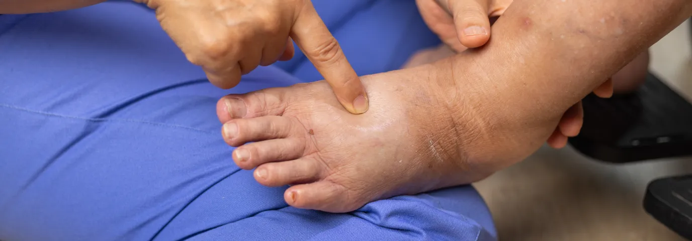 Fußpflege Senioren: Warum professionelle Fußgesundheit im Alter unverzichtbar ist